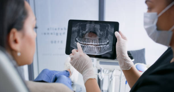 Licensed Dental Implants service in Chesterfield, IN - Smile Center Dentistry