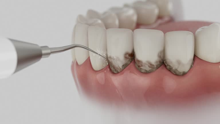 Reliable Dental Implants contractor in Chesterfield, IN by Smile Center Dentistry